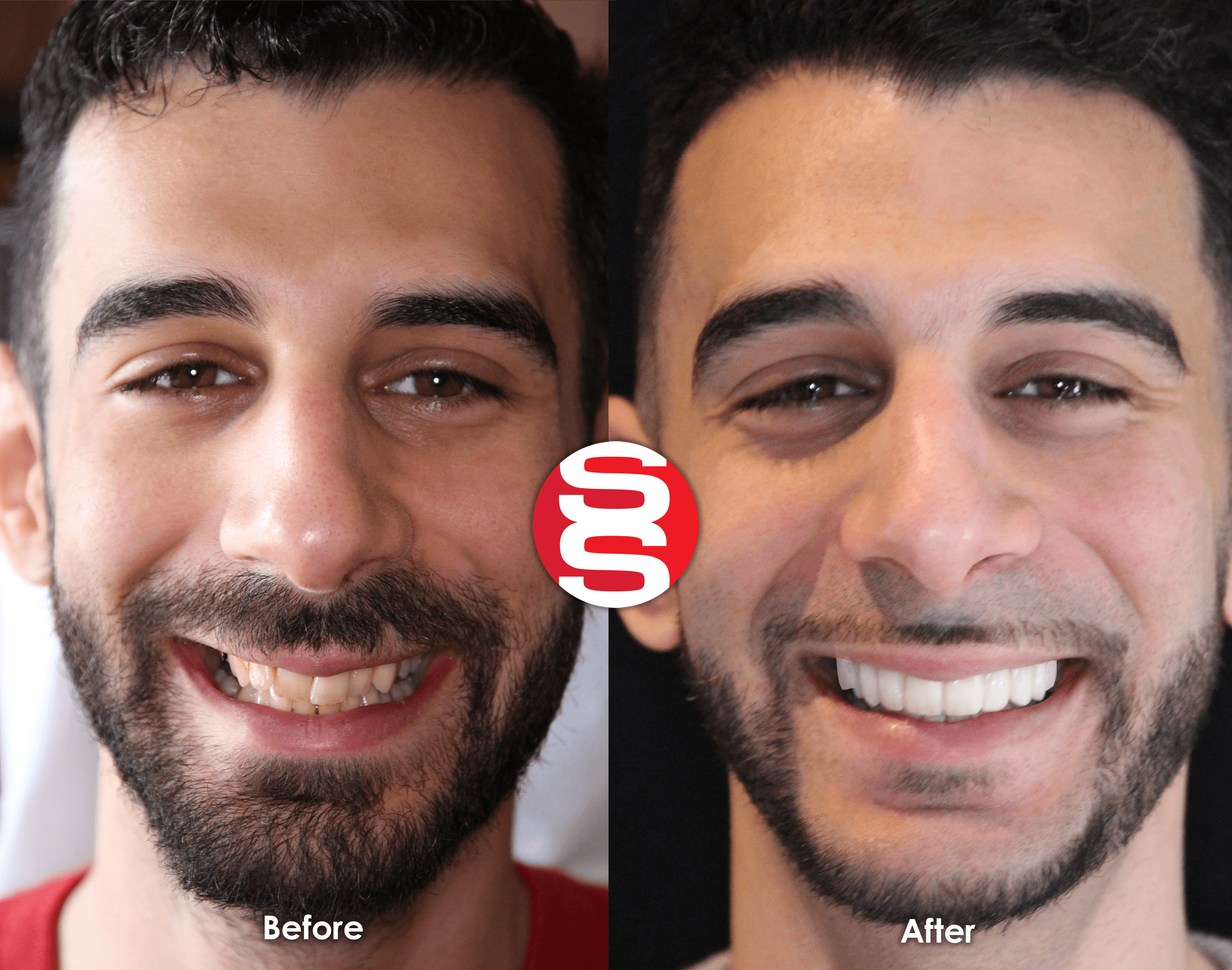Oct 11 - New Before After